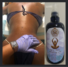 Load image into Gallery viewer, New New Post Operative Lymphatic Massage Oil
